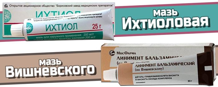 Забытый рецепт волшебной мази от варикозного расширения вен Забытый рецепт волшебной мази от варикозного расширения вен