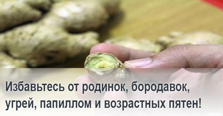 Избавьтесь от родинок, бородавок, угрей, папиллом и возрастных пятен!