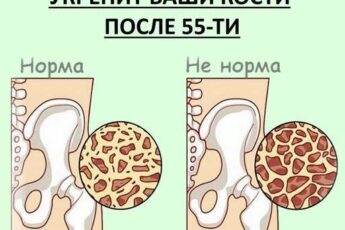 Не творог: ❌❌❓Вот что реально укрепит ваши кости после 55-ти