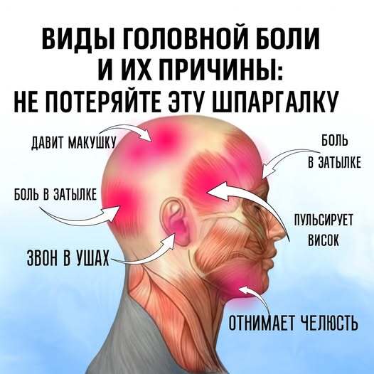 Виды головной боли и их причины: не потеряйте эту шпаргалку.