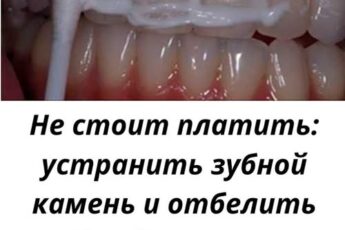 Узнайте, как быстро и безопасно удалить зубной налет и камень, отбелить зубы дома за 4 минуты с помощью простых натуральных средств и советов стоматолога.