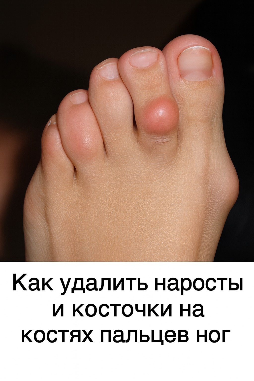 В 10-миллиграммовой бутылочке йода следует растворить пять таблеток обычного..