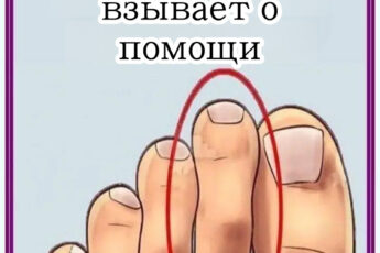 8 признаков, что ваше тело кричит о помощи