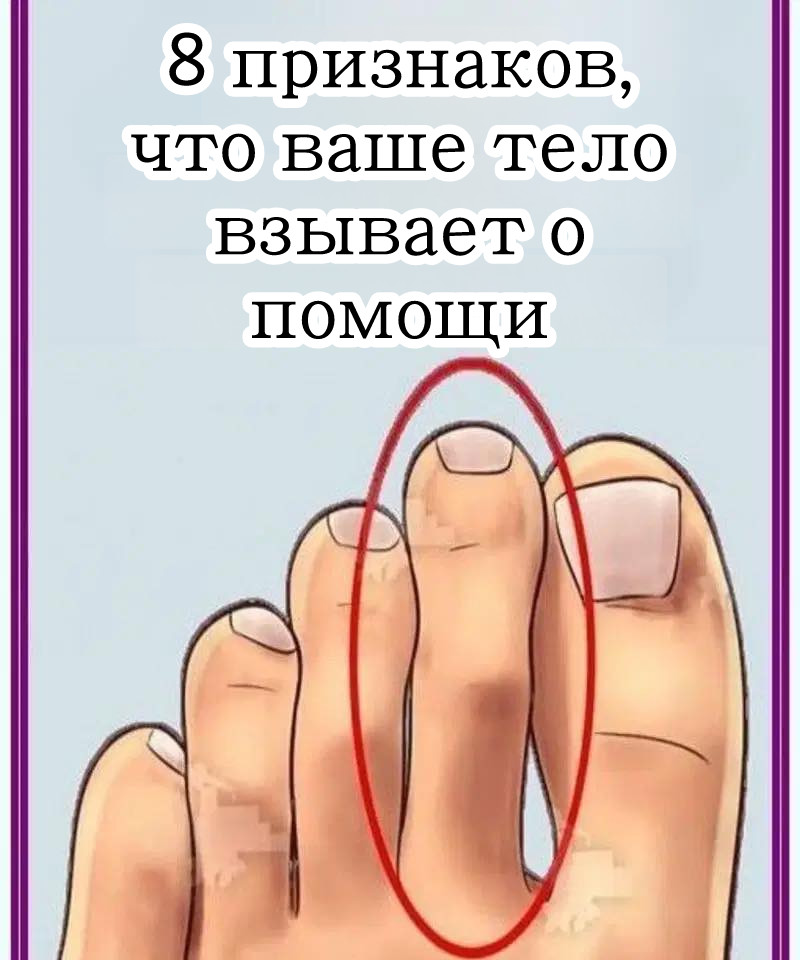 8 признаков, что ваше тело кричит о помощи