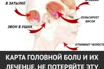 Карта головной боли и способы её лечения. Не потеряйте эту полезную шпаргалку