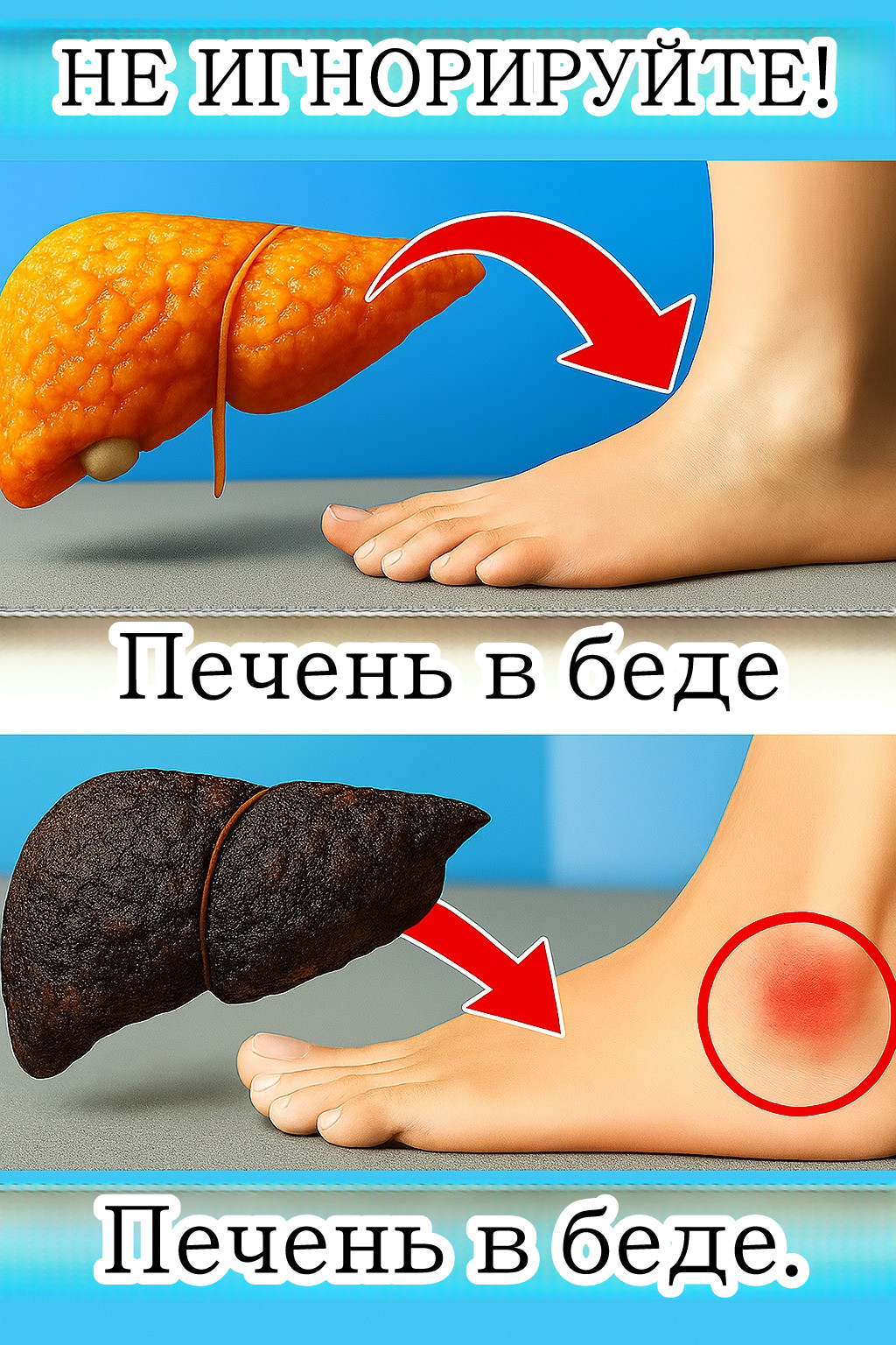 Ваши ноги: ранние признаки проблем с печенью.