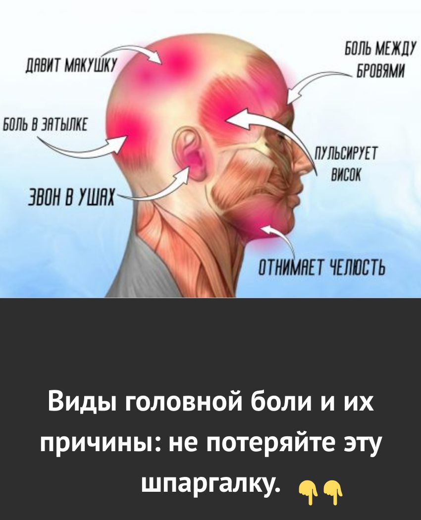 Виды головной боли и их причины: не потеряйте эту шпаргалку. Виды головной боли и их причины: не потеряйте эту шпаргалку.
