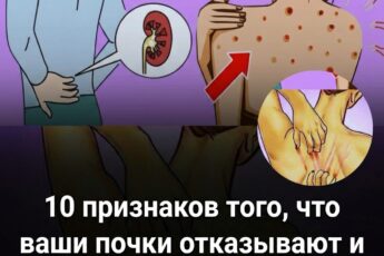 В случае сбоя в работе почек, организм подает эти 10 сигналов