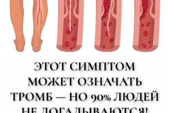 Этот симптом может означать тромб — но 90% людей не догадываются! Как распознать до беды