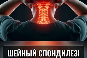 Разберитесь в том, что представляет собой шейный спондилез