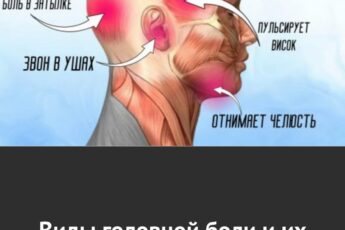 Виды головной боли и их причины: не потеряйте эту шпаргалку.