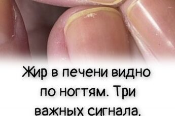 Жир в печени видно по ногтям. Три важных сигнала, которые игнорируют пожилые люди