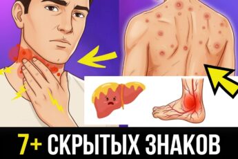 Жировая болезнь печени: тревожные сигналы, которые нельзя игнорировать