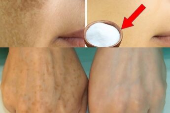 Я удалила пигментные пятна с помощью дешёвого ингредиента из кухни!