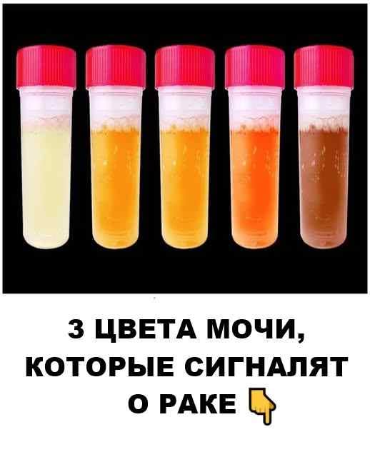 3 цвета мочи, которые сигналят о ...