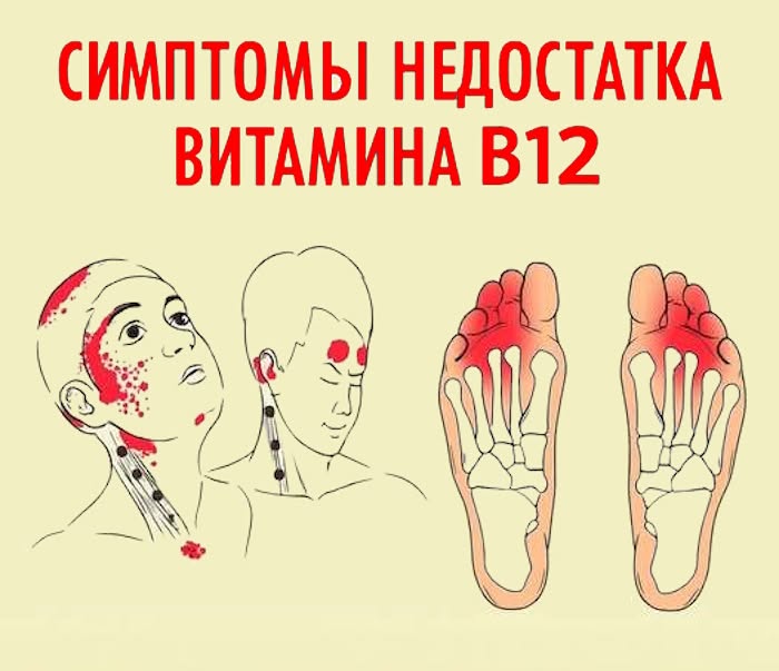 Постоянная усталость? 7 сигналов дефицита витамина B12, которые нельзя игнорировать!