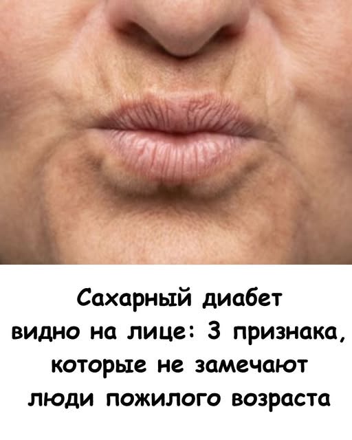 Сахарный диабет видно на лице: 3 признака, которые не замечают люди пожилого возраста