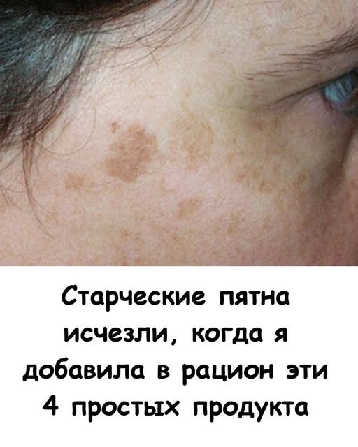 Старческие пятна ИСЧЕЗЛИ, когда я добавила в рацион эти 4 простых продукта.