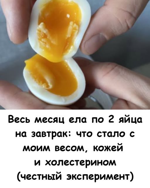 Весь месяц ела по 2 яйца на завтрак: что стало с моим весом, кожей и холестерином (честный эксперимент) Как на самом деле живется женщинам в Саудовской Аравии? Как на самом деле живется женщинам в Саудовской Аравии? More Details Ох уж эти яйца! Сколько споров вокруг них ведется: то врачи пугают холестерином и советуют есть не больше двух штук в неделю, то нутрициологи называют их «суперфудом» и призывают есть каждый день. Я долгое время осторожничала. Возраст всё-таки не юный, за сосудами следить надо. Ела омлет по выходным и думала, что берегу здоровье. Но недавно прочитала исследование о том, что пищевой холестерин в яйцах и тот, что забивает сосуды — это разные вещи. И решила провести свой маленький домашний эксперимент. Дочь Аллы Пугачевой не похожа на сверстников. Что же с ней не так Подробнее Целый месяц я съедала ровно по два яйца каждый день. Варила, жарила без масла, делала пашот. Результаты меня, честно говоря, удивили. Некоторые мифы в моей голове рассыпались в пух и прах. Делюсь с вами своими наблюдениями: что изменилось в самочувствии, внешности и (самое страшное!) в анализах. 1. Энергия перестала «скакать» Раньше к 11 утра мне уже хотелось перекусить. Чай с печеньем, бутерброд… Казалось, что завтрак «провалился». Но стоило ввести в рацион яйца, как всё изменилось. Яйца — это эталонный белок. Он усваивается идеально, но при этом дает очень долгое чувство сытости. Что я заметила: Позавтракав яичницей в 8 утра, я спокойно доживала до обеда без урчания в животе и желания съесть конфету. 6 ч 8 мин назад Диетологи не советуют принимать эти продукты регулярно Еще 386 86 370 9 ч 16 мин назад Продукты, которые нельзя есть каждый день Еще 459 25 96 1 ч 28 мин назад Куда делся Родион Газманов? Слухи оправдались Еще 369 128 213 7 ч 12 мин назад Пенсионерам до 8 октября рекомендовано привиться Еще 405 191 238 Энергия стала ровной, ушла вялость и сонливость после еды. Оказывается, белковый завтрак работает лучше любой каши. 2. Ногти перестали ломаться (приятный бонус) Примерно через две недели я обратила внимание на свои руки. Обычно зимой мои ногти слоятся и ломаются от любого прикосновения. А тут — крепкие, ровные, растут быстро. И волосы на расческе стали оставаться в меньшем количестве. Секрет прост: в желтке содержится биотин (витамин красоты) и сера. Это главные строительные кирпичики для наших волос и ногтей. Никакие дорогие шампуни не дадут такого эффекта, как питание изнутри. 1 ч 47 мин назад Врачи рассказали о 10 необыкновенных свойствах чеснока Еще 439 159 101 2 ч 44 мин назад Вы не поверите! Эти растения способны отравить всю вашу семью! Еще 459 101 276 3. Мозг заработал яснее В яйцах есть вещество с красивым названием холин. Это витамин В4, который критически важен для нашего мозга и памяти. Я заметила, что стала меньше забывать мелочи (куда положила очки, что нужно купить). Голова стала какой-то «светлой», легче концентрироваться на делах. Для нас, людей старшего возраста, профилактика возрастной забывчивости — это очень важно. И пара яиц справляется с этим на отлично. 4. А что с весом? Я не ставила цель похудеть. Но когда ты сыт и доволен до самого обеда, ты просто перестаёшь «кусочничать». Ушли лишние перекусы, чай с сахаром и печеньем. В итоге за месяц незаметно ушли 1,5 кг. Без диет и голодовок. Просто за счет того, что организм получал качественный белок и не требовал «быстрых» углеводов. 5. Главный страх: холестерин Это то, чего я боялась больше всего. «Вдруг сосуды забьются?» — думала я. В конце месяца я специально сдала кровь. И знаете что? Мой холестерин остался в норме! Врач объяснил: печень сама вырабатывает 80% холестерина. И если мы получаем его из еды (в разумных пределах!), печень просто снижает свою выработку. Более того, в яйцах есть лецитин, который, наоборот, не дает «плохому» холестерину оседать на стенках сосудов. Так что миф о том, что яйца — враг сердца, давно устарел (если, конечно, не жарить их на сале с беконом). Как я их готовила, чтобы было полезно Чтобы получить пользу, а не вред, я соблюдала простые правила: Желток должен быть жидким. Варила всмятку или делала глазунью. Переваренный желток (с серым ободком) усваивается хуже и теряет часть витаминов. Без майонеза. Ела с овощами, зеленью или просто с кусочком цельнозернового хлеба. Минимум масла. Если жарила, то на капле топленого масла или просто на антипригарной сковороде. Вывод Не бойтесь яиц! Это самый доступный и дешевый «суперфуд» в нашем холодильнике. Два яйца в день подарили мне бодрость, крепкие ногти и минус пару сантиметров в талии. А страшилки про холестерин оказались просто страшилками. Важно! Статья носит информационный характер и основана на личном опыте. Реакция организма индивидуальна. При наличии камней в желчном пузыре или аллергии обязательно консультируйтесь с врачом. Весь месяц ела по 2 яйца на завтрак: что стало с моим весом, кожей и холестерином (честный эксперимент)
Как на самом деле живется женщинам в Саудовской Аравии?
Как на самом деле живется женщинам в Саудовской Аравии?
More Details
Ох уж эти яйца! Сколько споров вокруг них ведется: то врачи пугают холестерином и советуют есть не больше двух штук в неделю, то нутрициологи называют их «суперфудом» и призывают есть каждый день.
Я долгое время осторожничала. Возраст всё-таки не юный, за сосудами следить надо. Ела омлет по выходным и думала, что берегу здоровье. Но недавно прочитала исследование о том, что пищевой холестерин в яйцах и тот, что забивает сосуды — это разные вещи. И решила провести свой маленький домашний эксперимент.
Дочь Аллы Пугачевой не похожа на сверстников. Что же с ней не так
Подробнее
Целый месяц я съедала ровно по два яйца каждый день. Варила, жарила без масла, делала пашот. Результаты меня, честно говоря, удивили. Некоторые мифы в моей голове рассыпались в пух и прах.
Делюсь с вами своими наблюдениями: что изменилось в самочувствии, внешности и (самое страшное!) в анализах.
1. Энергия перестала «скакать»
Раньше к 11 утра мне уже хотелось перекусить. Чай с печеньем, бутерброд… Казалось, что завтрак «провалился».
Но стоило ввести в рацион яйца, как всё изменилось.
Яйца — это эталонный белок. Он усваивается идеально, но при этом дает очень долгое чувство сытости.
Что я заметила:
Позавтракав яичницей в 8 утра, я спокойно доживала до обеда без урчания в животе и желания съесть конфету.
6 ч 8 мин назад
Диетологи не советуют принимать эти продукты регулярно
Еще
386
86
370
9 ч 16 мин назад
Продукты, которые нельзя есть каждый день
Еще
459
25
96
1 ч 28 мин назад
Куда делся Родион Газманов? Слухи оправдались
Еще
369
128
213
7 ч 12 мин назад
Пенсионерам до 8 октября рекомендовано привиться
Еще
405
191
238
Энергия стала ровной, ушла вялость и сонливость после еды. Оказывается, белковый завтрак работает лучше любой каши.
2. Ногти перестали ломаться (приятный бонус)
Примерно через две недели я обратила внимание на свои руки.
Обычно зимой мои ногти слоятся и ломаются от любого прикосновения. А тут — крепкие, ровные, растут быстро.
И волосы на расческе стали оставаться в меньшем количестве.
Секрет прост: в желтке содержится биотин (витамин красоты) и сера. Это главные строительные кирпичики для наших волос и ногтей.
Никакие дорогие шампуни не дадут такого эффекта, как питание изнутри.
1 ч 47 мин назад
Врачи рассказали о 10 необыкновенных свойствах чеснока
Еще
439
159
101
2 ч 44 мин назад
Вы не поверите! Эти растения способны отравить всю вашу семью!
Еще
459
101
276
3. Мозг заработал яснее
В яйцах есть вещество с красивым названием холин. Это витамин В4, который критически важен для нашего мозга и памяти.
Я заметила, что стала меньше забывать мелочи (куда положила очки, что нужно купить). Голова стала какой-то «светлой», легче концентрироваться на делах.
Для нас, людей старшего возраста, профилактика возрастной забывчивости — это очень важно. И пара яиц справляется с этим на отлично.
4. А что с весом?
Я не ставила цель похудеть. Но когда ты сыт и доволен до самого обеда, ты просто перестаёшь «кусочничать». Ушли лишние перекусы, чай с сахаром и печеньем.
В итоге за месяц незаметно ушли 1,5 кг. Без диет и голодовок. Просто за счет того, что организм получал качественный белок и не требовал «быстрых» углеводов.
5. Главный страх: холестерин
Это то, чего я боялась больше всего. «Вдруг сосуды забьются?» — думала я.
В конце месяца я специально сдала кровь. И знаете что? Мой холестерин остался в норме!
Врач объяснил: печень сама вырабатывает 80% холестерина. И если мы получаем его из еды (в разумных пределах!), печень просто снижает свою выработку.
Более того, в яйцах есть лецитин, который, наоборот, не дает «плохому» холестерину оседать на стенках сосудов.
Так что миф о том, что яйца — враг сердца, давно устарел (если, конечно, не жарить их на сале с беконом).
Как я их готовила, чтобы было полезно
Чтобы получить пользу, а не вред, я соблюдала простые правила:
Желток должен быть жидким. Варила всмятку или делала глазунью. Переваренный желток (с серым ободком) усваивается хуже и теряет часть витаминов.
Без майонеза. Ела с овощами, зеленью или просто с кусочком цельнозернового хлеба.
Минимум масла. Если жарила, то на капле топленого масла или просто на антипригарной сковороде.
Вывод
Не бойтесь яиц! Это самый доступный и дешевый «суперфуд» в нашем холодильнике.
Два яйца в день подарили мне бодрость, крепкие ногти и минус пару сантиметров в талии. А страшилки про холестерин оказались просто страшилками.
Важно! Статья носит информационный характер и основана на личном опыте. Реакция организма индивидуальна. При наличии камней в желчном пузыре или аллергии обязательно консультируйтесь с врачом.